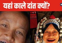 इस देश में काले रंग के रंगवाते थे दांत, लोगों को पसंद नहीं था सफेद, कभी घूमी है ये अनोखी जगह?
