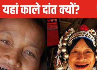 इस देश में काले रंग के रंगवाते थे दांत, लोगों को पसंद नहीं था सफेद, कभी घूमी है ये अनोखी जगह?