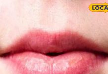 क्या आपके भी गुलाबी होंठ हो रहे हैं डार्क, तुरंत फॉलो करें ये टिप्स