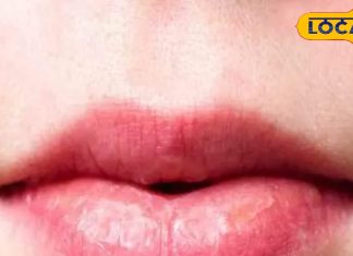 क्या आपके भी गुलाबी होंठ हो रहे हैं डार्क, तुरंत फॉलो करें ये टिप्स