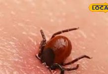 рдХреНрдпрд╛ рд╣реИ рд╕реНрдХреНрд░рдм рдЯрд╛рдЗрдлрд╕? рдЗрд╕рдХрд╛ рдЬрд▓реНрдж рдЗрд▓рд╛рдЬ рдмреЗрд╣рдж рдЬрд░реВрд░реА, рдбреЙрдХреНрдЯрд░ рд╕реЗ рдЬрд╛рдирд┐рдП рд▓рдХреНрд╖рдг рдФрд░ рдмрдЪрд╛рд╡