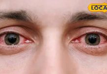 बारिश के पानी से आंखों में है जलन? इसे रगड़ने या मसलने की न करें भूल, अपनाएं ये घरेलू नुस्खे