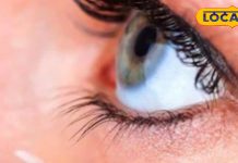 आई कॉन्टेक्ट लेंस कर सकते हैं अंधा, इस गलती से हो सकता है कार्निया ब्लाइंडनेस