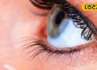 आई कॉन्टेक्ट लेंस कर सकते हैं अंधा, इस गलती से हो सकता है कार्निया ब्लाइंडनेस