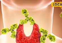 ये हैं थायराइड को कंट्रोल करने वाले एक से बढ़कर एक देशी नुस्खे, 15 दिनों में दिखने लगेगा सुधार