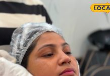 बेहद कमाल का है हल्दी, केवड़ा और नीम का पेस्ट, सात दिनों में मिटा देता है दाग-धब्बे और झुर्रियां-The paste of turmeric, kewra and neem is amazing, it removes spots and wrinkles in seven days