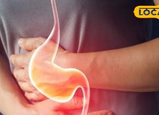 बरसात में खूब फैलती ये बीमारी,कर लें बचाव की तैयारी,नहीं तो जाना पड़ेगा अस्पताल