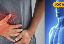 फेटी लीवर की समस्या से हैं परेशान? तो अपनाएं ये घरेलू उपाय, होम्योपैथिक में जड़ से खत्म करने का दावा