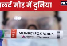 Monkeypox: कोरोना की तरह डराने लगा मंकीपॉक्स! अब तक 100 की मौत, अफ्रीका के बाहर भी मिला मरीज