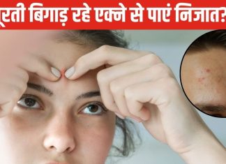 चेहरे की खूबसूरती का हो रहा सत्यानाश? माथे पर बार-बार निकल आते हैं मुहांसे? निजात पाने के लिए अपनाएं ये 5 उपाय