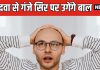 अब गंजेपन से छुटकारा दिलाएगी मीठी दवा ! सिर पर लगाने से दोबारा उगेंगे बाल, वैज्ञानिकों ने किया बड़ा दावा