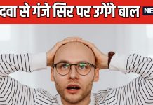 अब गंजेपन से छुटकारा दिलाएगी मीठी दवा ! सिर पर लगाने से दोबारा उगेंगे बाल, वैज्ञानिकों ने किया बड़ा दावा