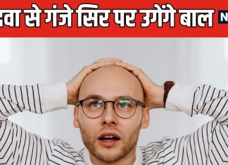 अब गंजेपन से छुटकारा दिलाएगी मीठी दवा ! सिर पर लगाने से दोबारा उगेंगे बाल, वैज्ञानिकों ने किया बड़ा दावा