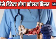 अब खून की जांच से कैंसर का चलेगा पता, FDA ने ब्लड बेस्ड टेस्ट को दी मंजूरी, स्क्रीनिंग प्रोसेस होगी आसान
