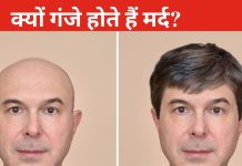 क्यों झड़ जाते हैं मर्दों के बाल? गंजेपन की बड़ी वजह है ये चीज, फॉलो करेंगे ये टिप्स तो हो जाएंगे घने