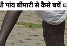 हाथी की तरह फूल जाते हैं हाथ-पांव, इस बीमारी का यूपी-बिहार में आतंक, अब सरकार ने की भगाने की तैयारी