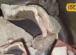 पथरी गुर्दा की हो या पित्त की…चूरा करके बाहर निकाल देगी ये छाल, लेप लगाने…