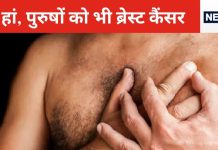 पुरुषों में भी हो सकता है ब्रेस्ट कैंसर, छाती में इस तरह से दिखे गांठ तो तुरंत उठाएं ये कदम, देरी पर हो सकती है मुश्किल