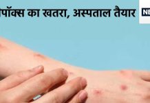 मंकीपॉक्स को लेकर अलर्ट, दिल्ली के इन अस्पतालों में आइसोलेशन वॉर्ड तैयार, यहां आएंगे संदिग्ध मरीज