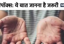 बुखार के साथ शरीर पर दाने, तो हो गया मन्कीपॉक्स? AIIMS के डॉक्टर ने दिया हैरान करने वाला जवाब