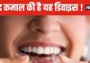 रात को मुंह में लगाकर सो जाएं यह खास चीज, 5 दिक्कतों से मिलेगा छुटकारा ! मोती की तरह चमकेंगे दांत