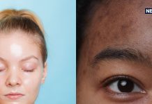 स्किन के लिए जरूरी हैं ये 2 विटामिन, कमी हुई तो निखार हो जाएगा डाउन, दिखेंगे बीमार