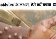 क्या भारत में भी फैल सकता है मंकीपॉक्स? अभी तक कितने आए केस, क्या हैं लक्षण, यहां है हर डिटेल