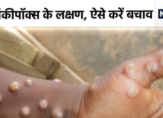 क्या भारत में भी फैल सकता है मंकीपॉक्स? अभी तक कितने आए केस, क्या हैं लक्षण, यहां है हर डिटेल