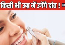 अगर 30 की उम्र में गिर गए हैं दांत, तो टेंशन मत लीजिए, जल्द मार्केट में आएगी नए दांत उगाने वाली दवा !