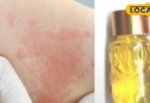 सावधान! त्वचा के लिए हानिकारक है केमिकल से बने इत्र, जान लें ये गंभीर नुकसान – Bharat.one हिंदी