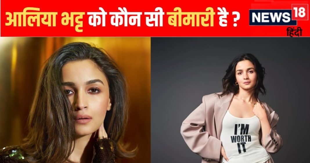 आलिया भट्ट को है ADD डिसऑर्डर, 32 की उम्र में बच्चों वाली बीमारी से हैं परेशान