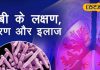 गोविंदपुर में चलाया जा रहा “टीबी हारेगा देश जीतेगा” अभियान, जानें इसके लक्षण और बचाव के उपाय