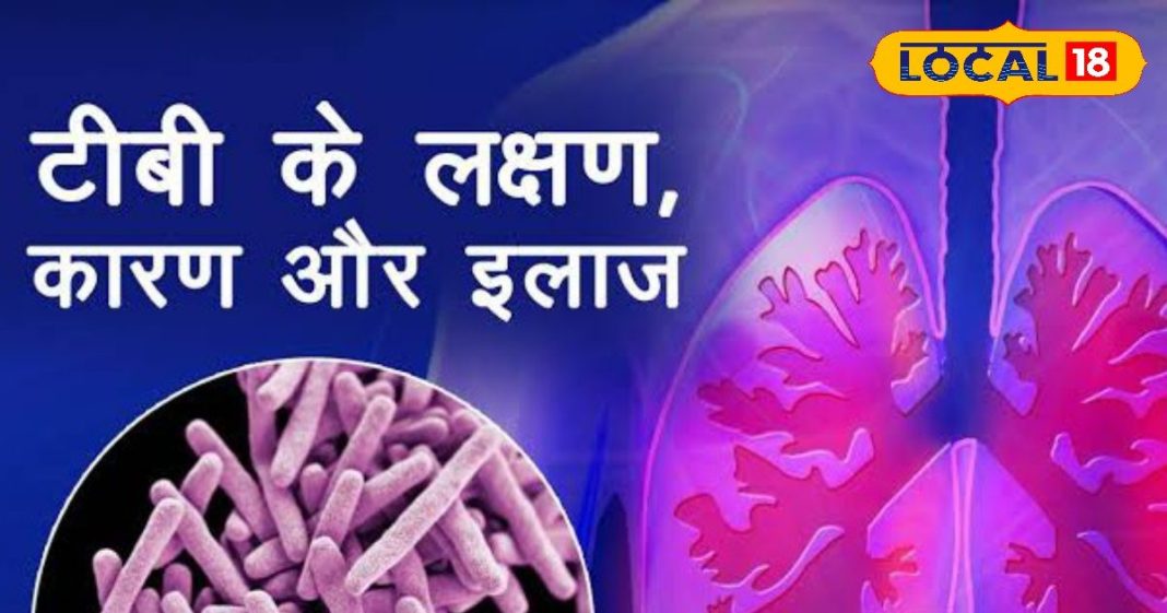 गोविंदपुर में चलाया जा रहा “टीबी हारेगा देश जीतेगा” अभियान, जानें इसके लक्षण और बचाव के उपाय