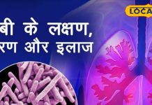 गोविंदपुर में चलाया जा रहा “टीबी हारेगा देश जीतेगा” अभियान, जानें इसके लक्षण और बचाव के उपाय