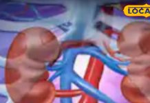 किडनी मरीजों के लिए जानलेवा हो सकते हैं ये फूड, भूलकर भी न करें सेवन