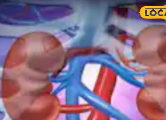 किडनी मरीजों के लिए जानलेवा हो सकते हैं ये फूड, भूलकर भी न करें सेवन