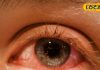 बारिश में फैल रही आंखों की बीमारी, आंखें लाल होने पर इन बातों का रखें ध्यान…