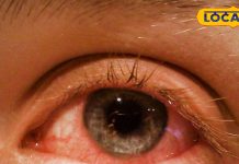 बारिश में फैल रही आंखों की बीमारी, आंखें लाल होने पर इन बातों का रखें ध्यान…