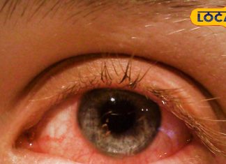 बारिश में फैल रही आंखों की बीमारी, आंखें लाल होने पर इन बातों का रखें ध्यान…