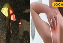 बरसात में फोड़े-फुंसी समेत चर्म रोग से हैं परेशान, तो अपनाएं ये उपाय, जानें डॉक्टर की सलाह