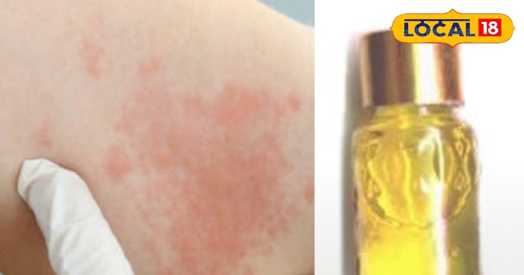 सावधान! केमिकल से बने इत्र को लगाने से शरीर में होता है इन्फेक्शन, जानिए क्या कहते हैं स्किन एक्सपर्ट