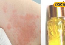 सावधान! केमिकल से बने इत्र को लगाने से शरीर में होता है इन्फेक्शन, जानिए क्या कहते हैं स्किन एक्सपर्ट