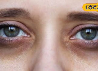 рдбрд╛рд░реНрдХ рд╕рд░реНрдХрд▓ рдХреА рд╣реЛ рдЬрд╛рдПрдЧреА рдЫреБрдЯреНрдЯреА, рдЪреЗрд╣рд░реЗ рдкрд░ рдЖрдПрдЧрд╛ рдирд┐рдЦрд╛рд░, рдмрд╕ рдбрд╛рдЗрдЯ рдореЗрдВ рдХрд░реЗрдВ рдпрд╣ рдмрджрд▓рд╛рд╡