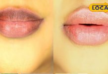 होठों का अचानक काला होना इस बीमारी का है संकेत, न करें लापरवाही