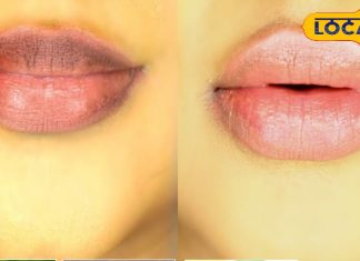 होठों का अचानक काला होना इस बीमारी का है संकेत, न करें लापरवाही