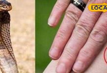 सांप के काटने पर भूलकर भी न करें यह काम, वरना जा सकती है जान, जानें एक्सपर्ट की सलाह