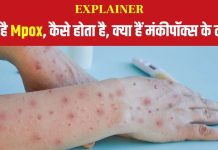 Explainer: भारत में मिला मंकी पॉक्स का जानलेवा स्ट्रेन, क्या है ये? कैसे फैलती है बीमारी, क्या हैं लक्षण