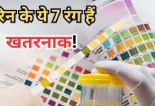पेशाब के किस रंग छिपे होते हैं किस बीमारी के संकेत, इस चार्ट में चल जाएगा पता, जान लेंगे तो फायदे में रहेंगे