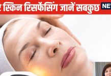 Skin Treatment: क्या है लेजर स्किन रिसर्फेसिंग? एक्सपर्ट से जानें फायदे-नुकसान, ट्रीटमेंट के बाद की सावधानियां