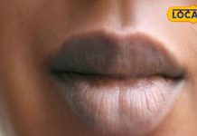 काले होठों को गुलाबी करने के लिए नहीं पड़ेगी लिप बाम की जरूरत, अपनाएं ये टिप्स